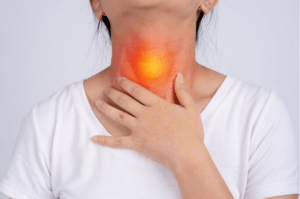 VA Disability for Esophageal Cancer